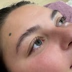 Eyelash Lifting