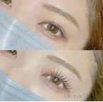 Lashlift (Upper)