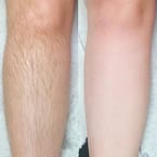 Épilation Jambes Complètes