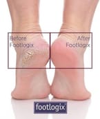 Footlogix Spa