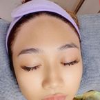 Forehead