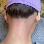 Nape
