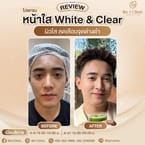 Meso Whitening