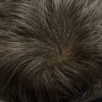 Targeted Hair Density Treatment by Pro Master