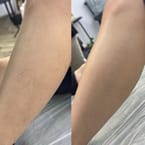 Half Legs Waxing