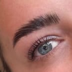 Brows Lifting