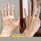 Hand Massage & Toksen