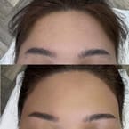 Eyebrows + Hairline Combo