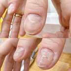 Manicure Rid of Cuticle