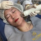 Acne Treatment 4 steps 