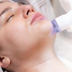 Acne Scar & Pore Tightening Laser