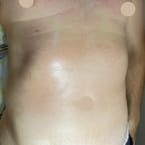 Abdomen