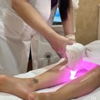 Legs Laser (Upper or Lower)