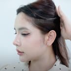 Receding Hairline Treatment by Pro Master