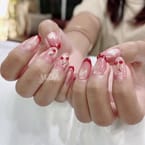 Gel Overlay Strengthening