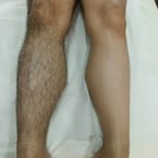 Half Legs