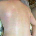 Back