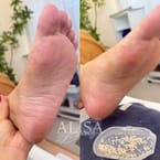 Foot Spa and Heel Scrub