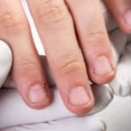 Bitten Nail Start