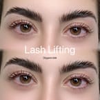 Eyebrows Lifting