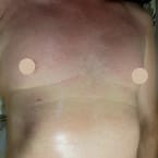 Chest