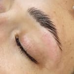 Eyebrow Lifting
