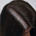 Grey Hair Coverage