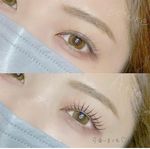 Lashlift (Upper)