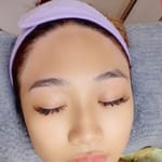 Forehead