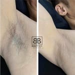 Underarm Waxing