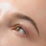 Brow Lift