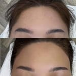 Eyebrows + Hairline Combo