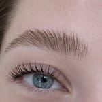 Brows Lifting