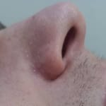Nose Hair