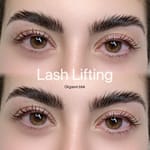 Eyebrows Lifting