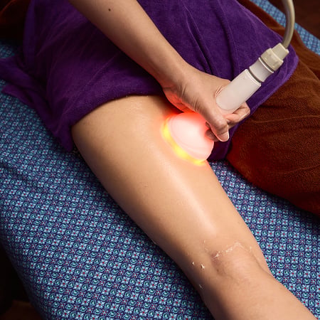 Body Contouring with RF+Vacuum+LED