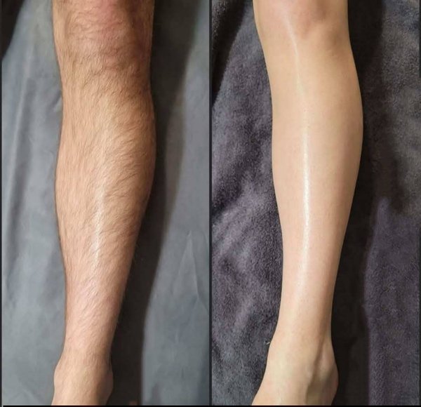 Waxing Time - Sukhumvit 4 (Nana) Bangkok 10110 13 - SeeU Beauty