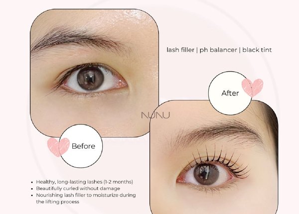 Classe Beauty Studio Bangkok 10110 10 - SeeU Beauty