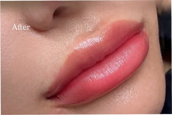Kove Aesthetic Studio Bangkok 10330 18 - SeeU Beauty