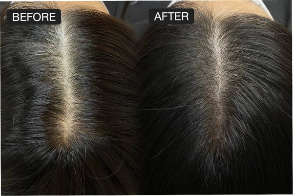 Kove Aesthetic Studio Bangkok 10330 13 - SeeU Beauty