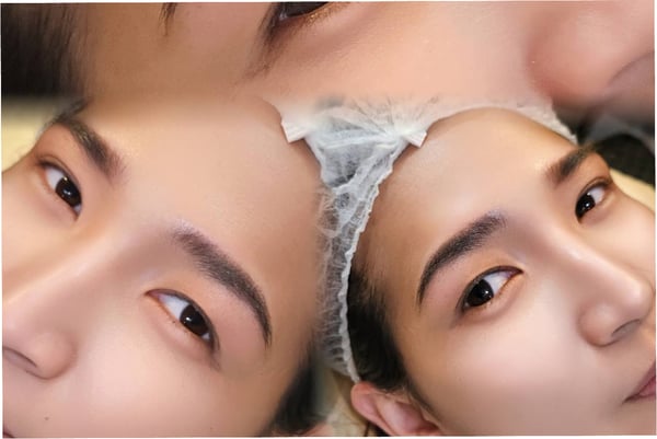 Kove Aesthetic Studio Bangkok 10330 19 - SeeU Beauty