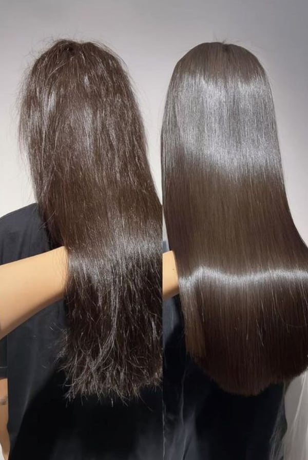 Kove Aesthetic Studio Bangkok 10330 3 - SeeU Beauty