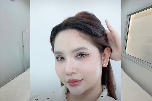 Kove Aesthetic Studio Bangkok 10330 14 - SeeU Beauty