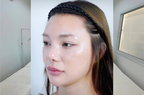 Kove Aesthetic Studio Bangkok 10330 6 - SeeU Beauty