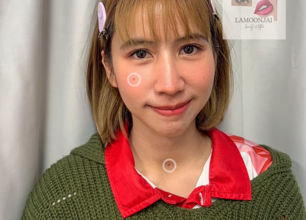 Lamoonjai Beauty Bangkok 10160 5 - SeeU Beauty